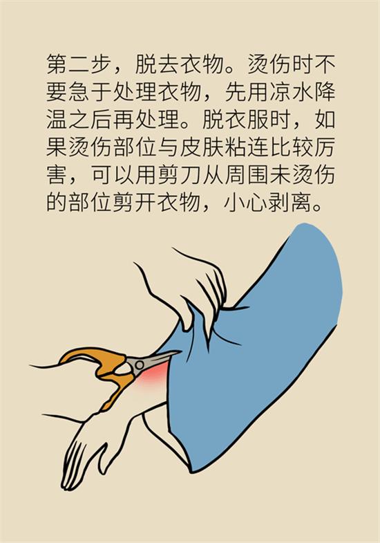 烧伤有水泡创面如何处理,烧伤烫伤起泡怎么处理