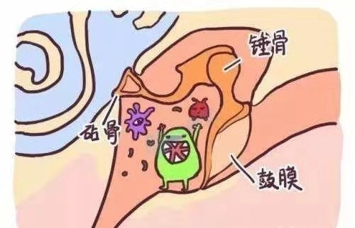 治中耳炎用眼药水,中耳炎常用药