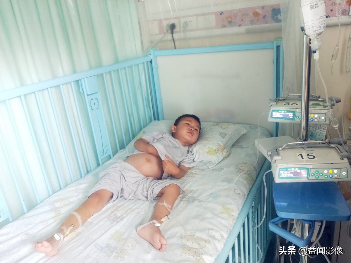 四周岁男孩腹胀,6岁男童肚痛呕吐消化不良