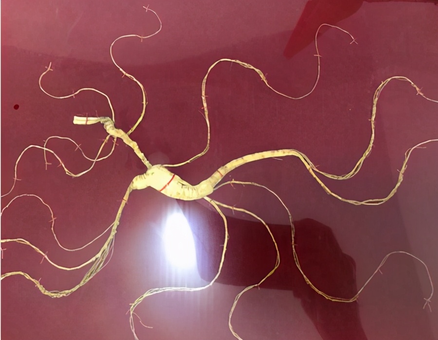 按照这5种方法选人参，十有八九选得好，经验之谈慢慢看