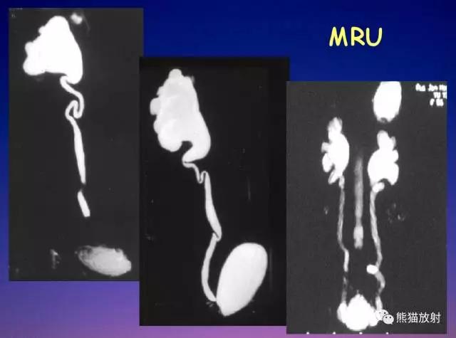 磁共振泌尿系水成像检查注意事项,磁共振影像基础知识讲解