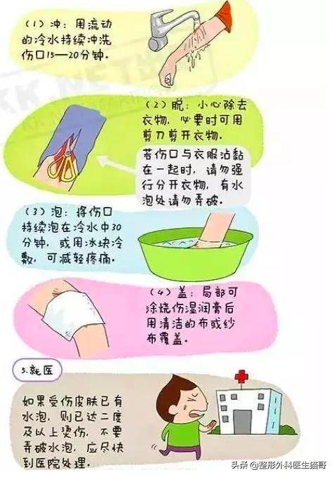 烫伤后还在用牙膏？你需要协和医生的烫伤应急小妙招