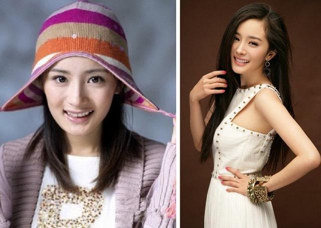 哪些明星整牙后像整容,明星整牙变美了