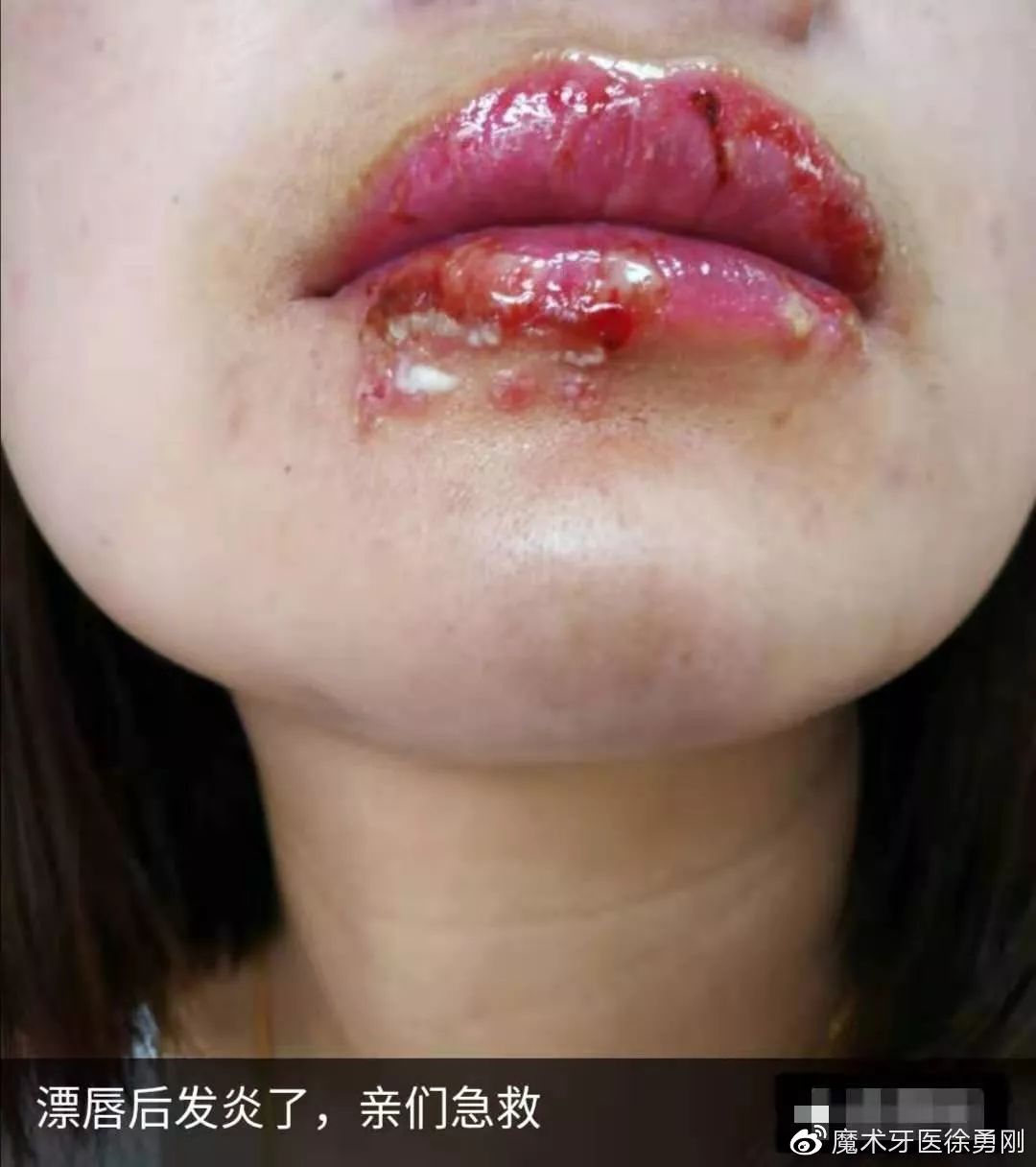 内行人为什么不建议漂唇,作为一名医生一直被人质疑