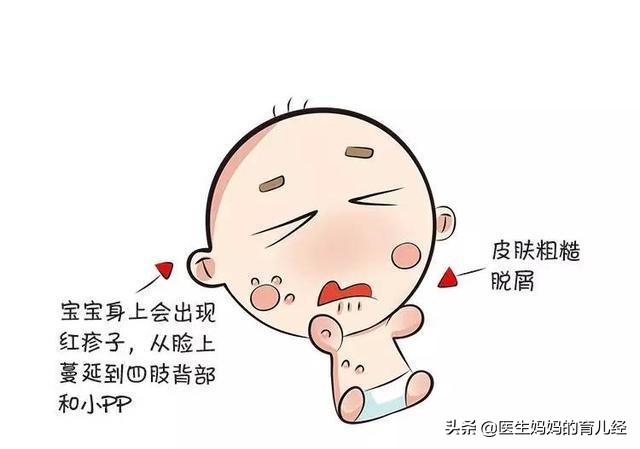 宝宝常见疾病及处理方法,宝宝的十个常见疾病
