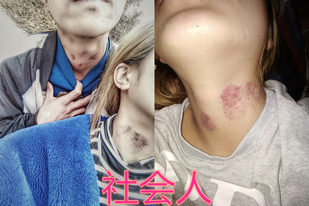 同样是“种草莓”，社会人热烈，渣女奔放，看到学生*党**：瞬间爱了