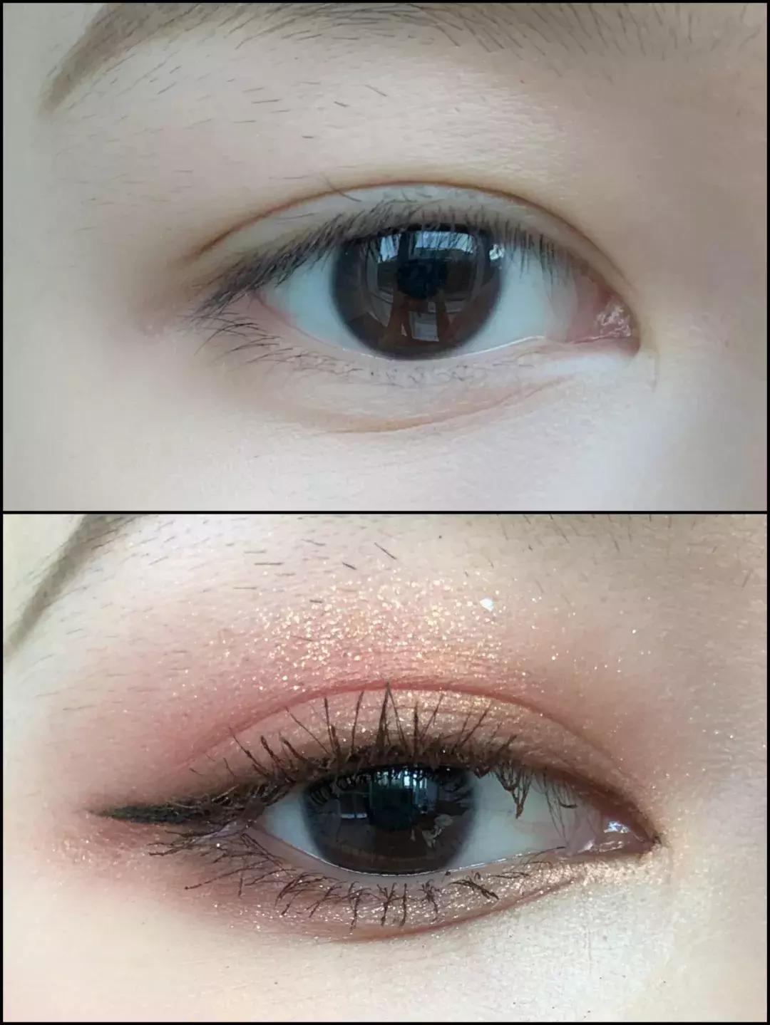 去割双眼皮,去韩国割双眼皮科学不