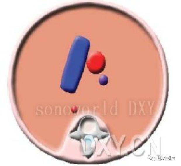 胎儿心脏三种血管关系模式图,25周的胎儿心脏弓切面多少正常