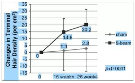 双十一值得入手的牌子,双十一值得买的大牌