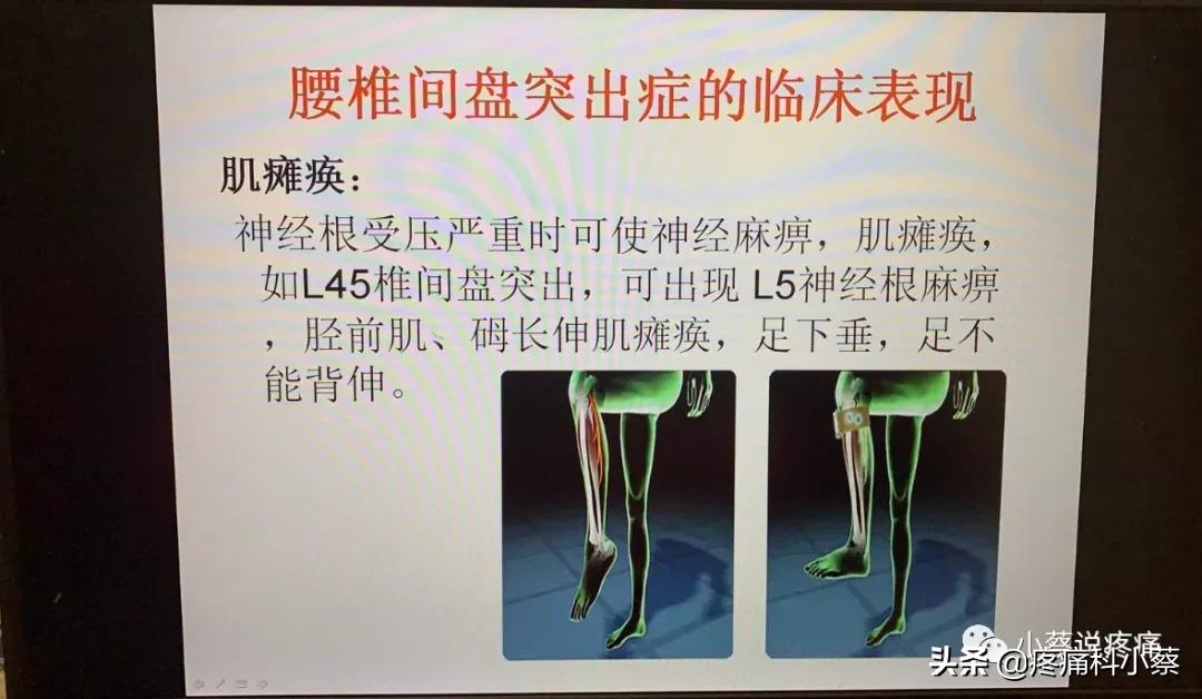 蔡主任讲座视频,蔡主任团队