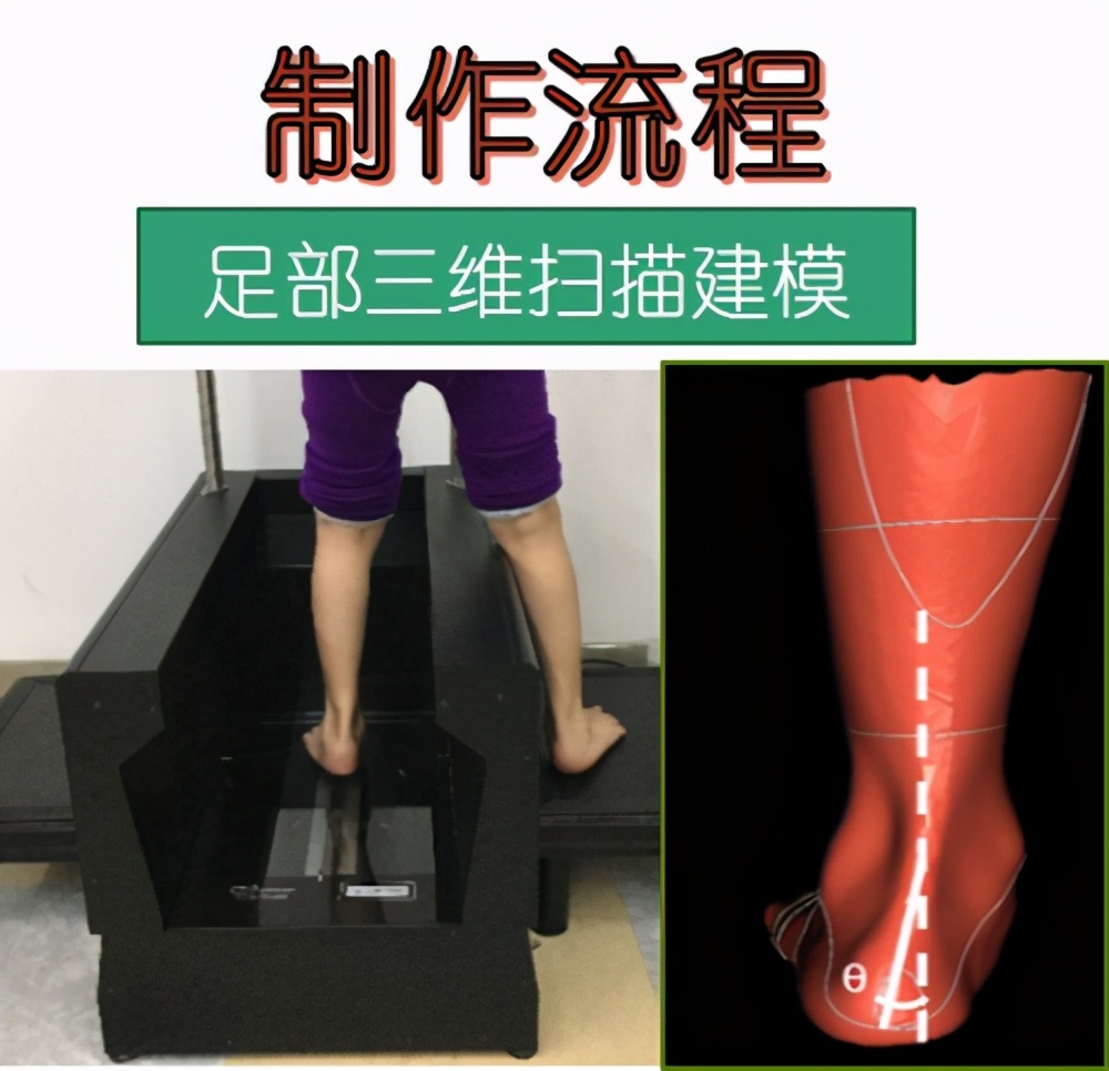 矫形鞋垫前后对比,矫形鞋和矫形鞋垫