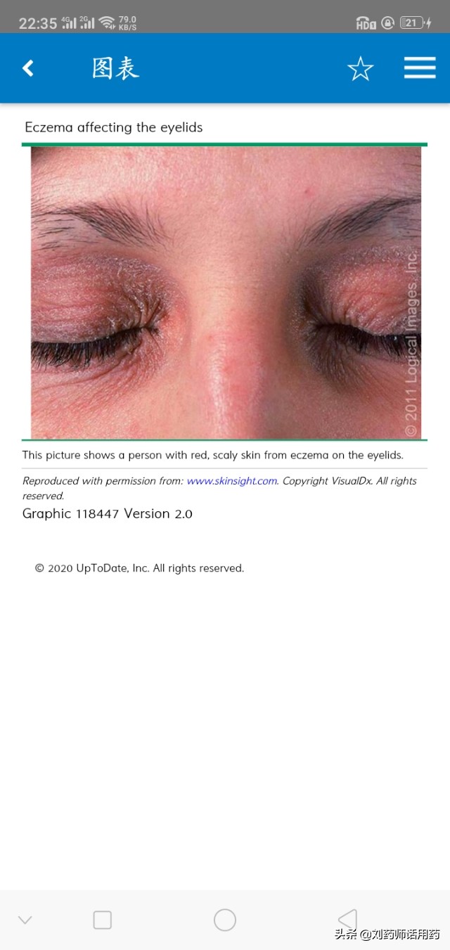 湿疹是皮肤太干还是太湿,湿疹是因为身体有湿热吗