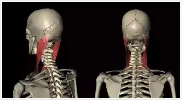 胸锁乳突肌粗大,胸锁乳突肌症状