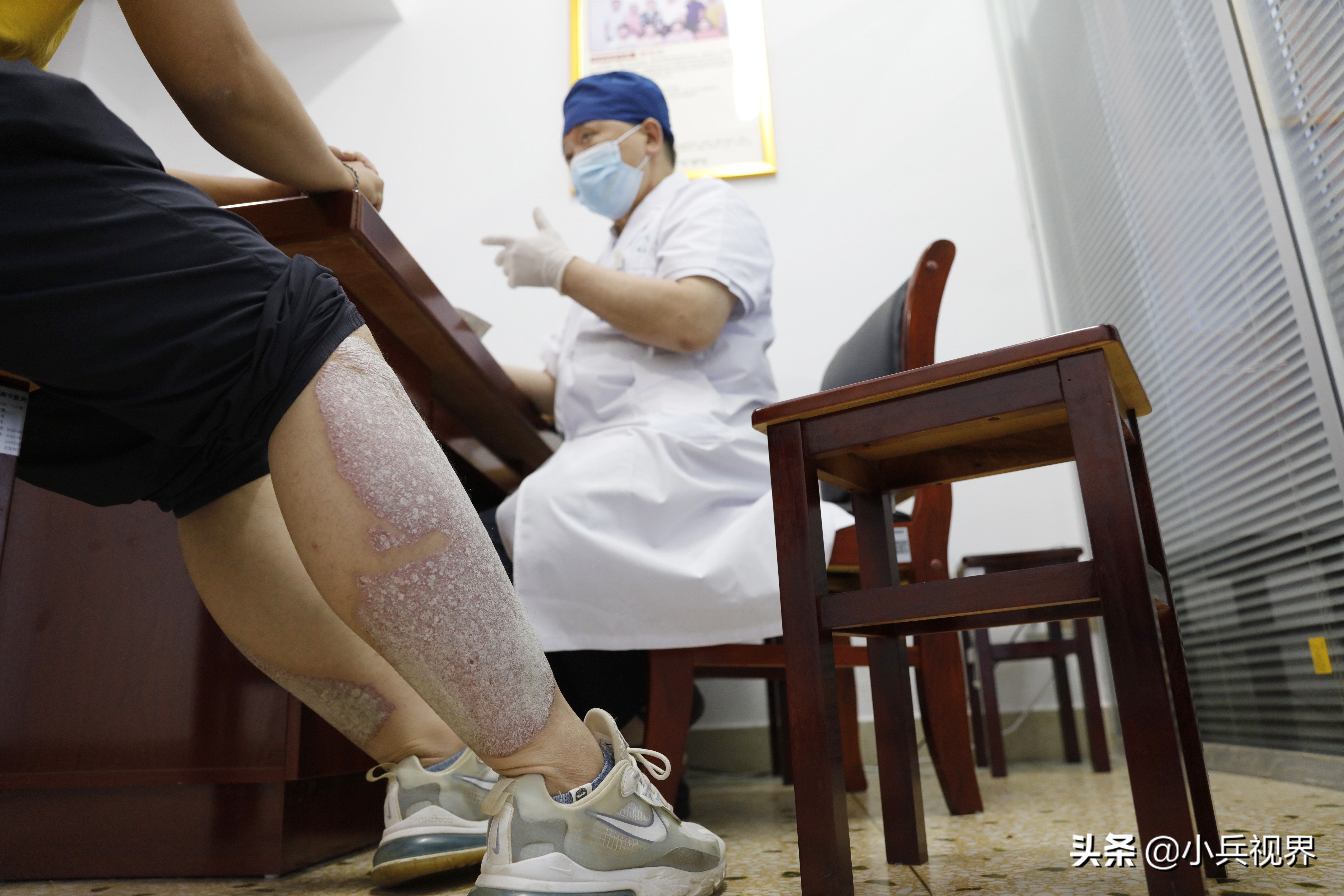 专治皮肤病疑难杂症的老中医,从医40年专治一种病