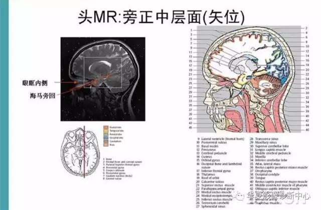 mra头颅解剖学详细讲解视频,常见的头颅mri图像