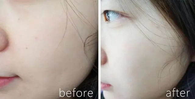 睡前坚持皮肤变好,睡前两个动作皮肤变好