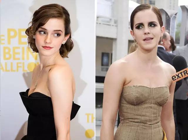 改善含胸驼背弹力带有用吗,弹力带含胸驼背改善训练