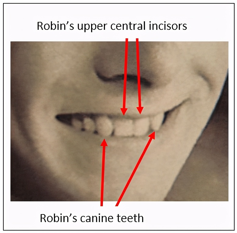 澳大利亚1948年未解悬案,西装男离奇躺在沙滩上,可疑护士被吓晕