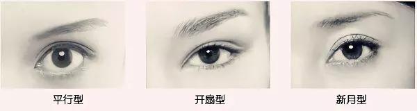 整形一般先做轮廓还是五官,五官整容顺序