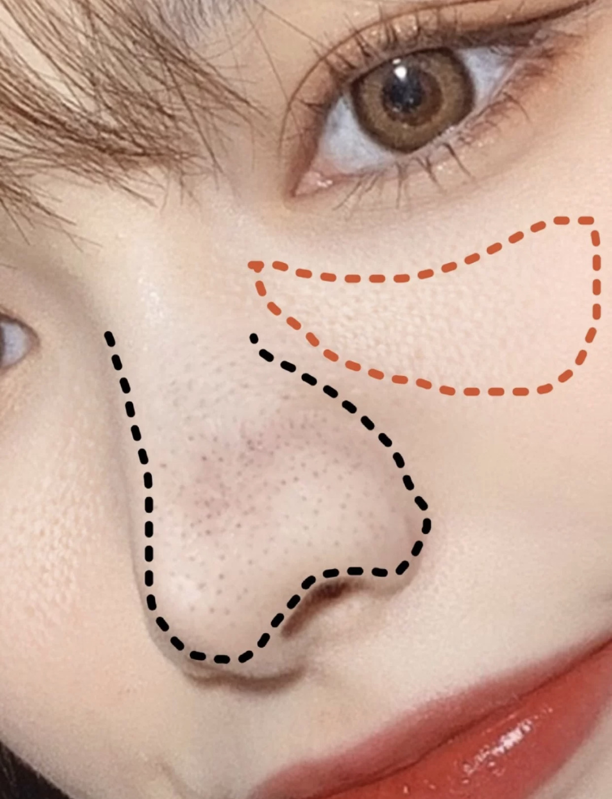 去黑头的几大“雷品”!城野医生用处不大,黑炭硬撕你敢用?