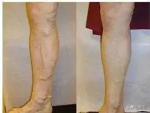 娜扎长筒袜,娜扎瘦腿袜