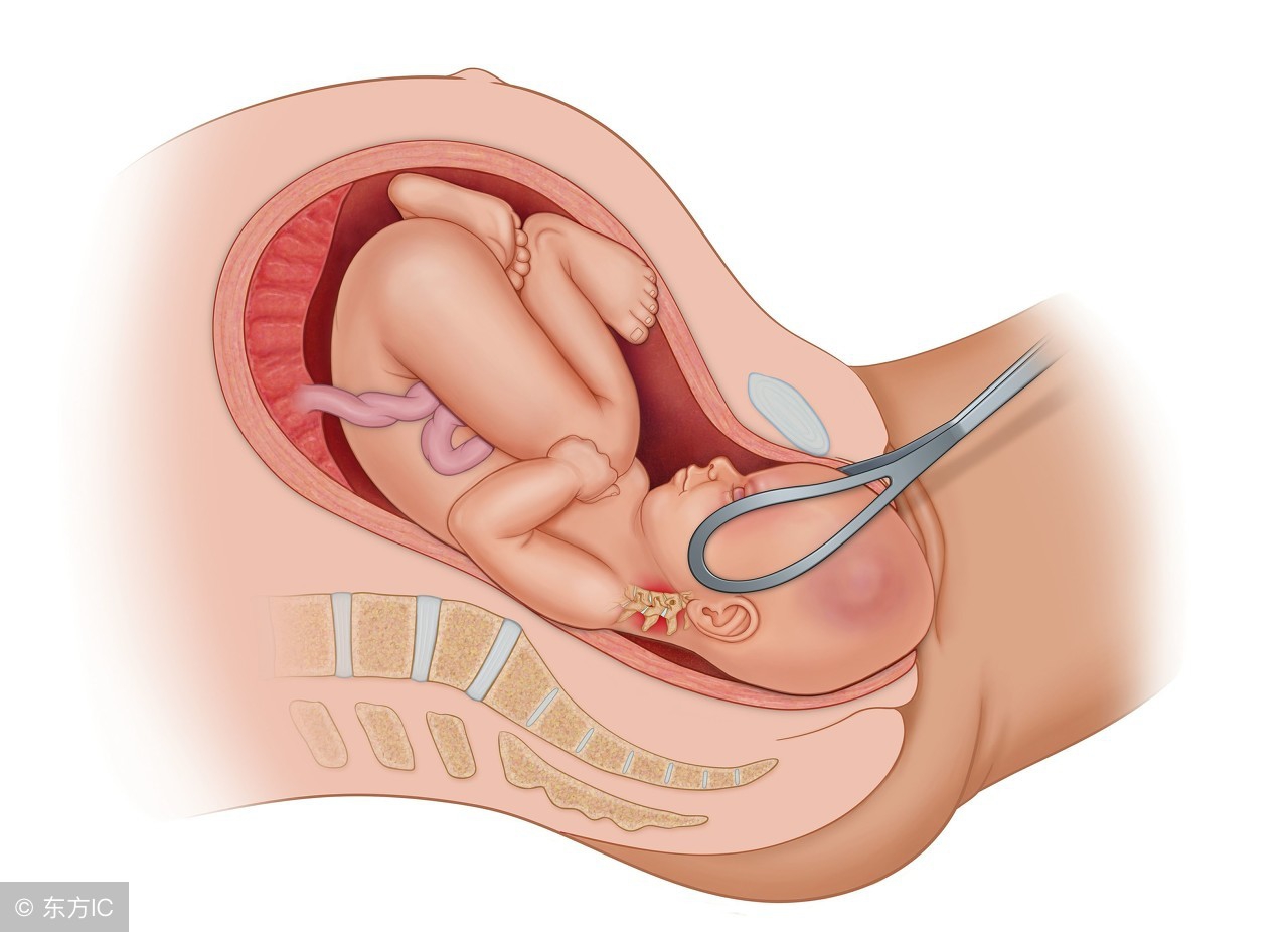 三胎分娩前的征兆都有哪些,孕妇分娩前有什么征兆