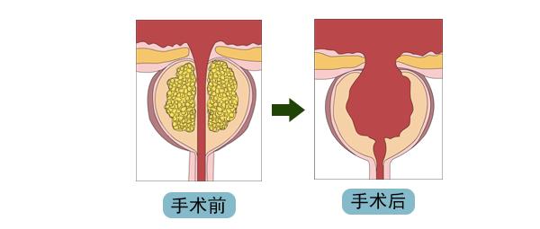 一文读懂痛风,一文读懂类风湿