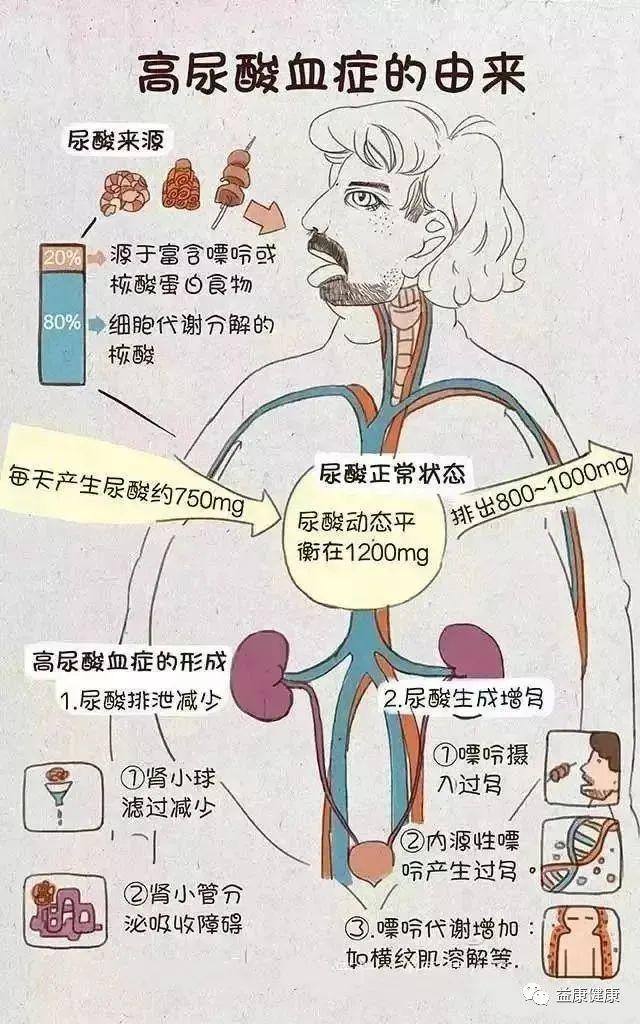 尿酸高看脚就知道,尿酸高看中医看多久