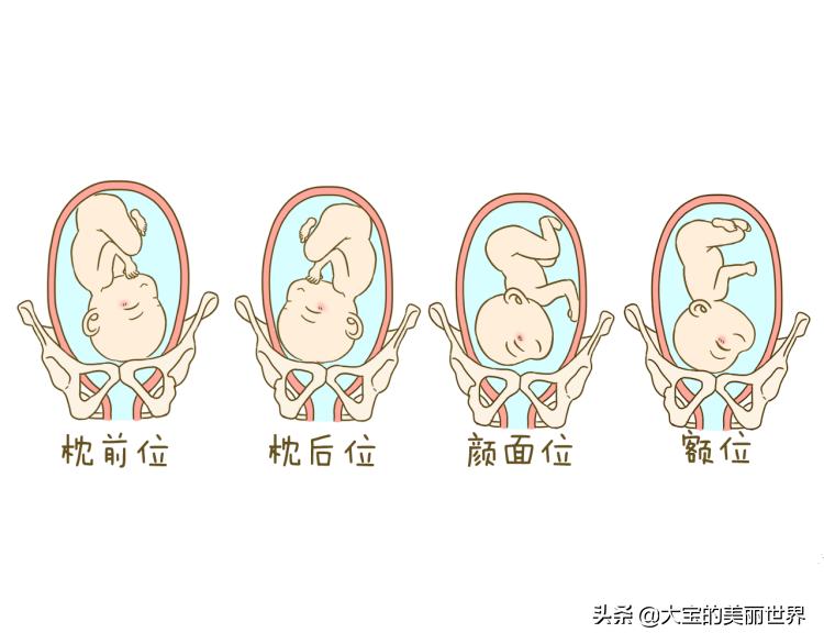 孕期胎位不正准妈妈莫慌张!