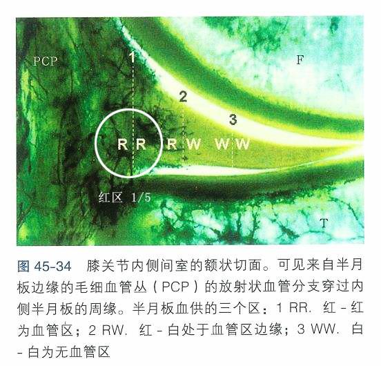 面对多种治疗半月板损伤的办法，我们应该做加法还是做减法？