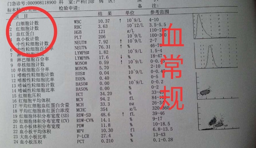拔牙，就是简单的将牙齿扯出，真是这样吗？|口腔医生：拔牙无小事