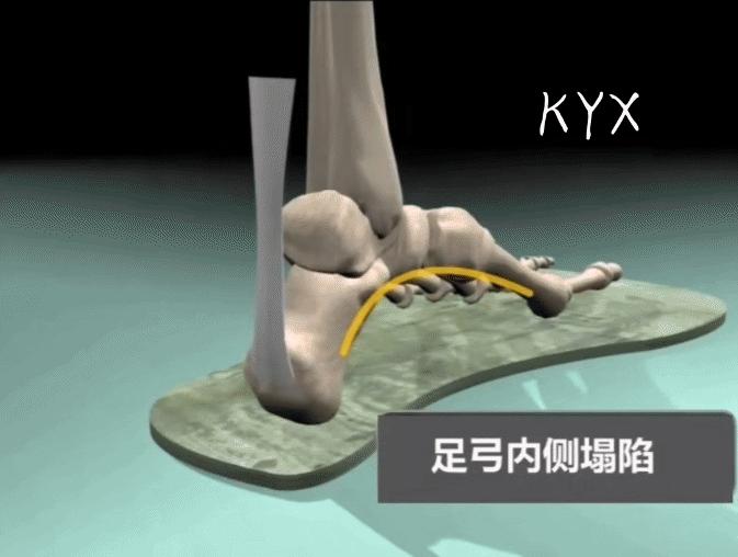 脚底板疼痛是什么原因如何治疗,脚底板痛的具体描述