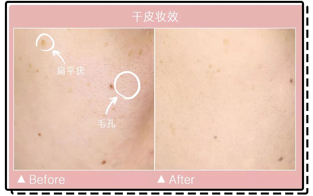 李佳琦养肤气垫霜,李佳琦养肤粉饼