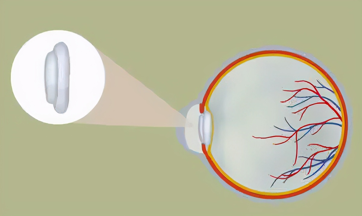 小孩眼睛痒是有虫子吗,儿童眼痒掏出六条虫