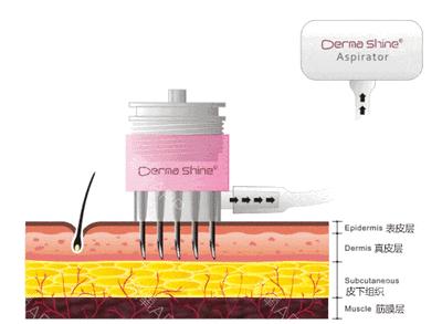 郑爽同款漫画腿不动刀也能get？吴昕的萝卜腿有救了