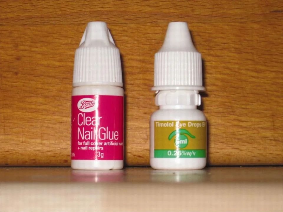 误把502胶水当作眼药水滴眼,502胶水怎么当眼药水