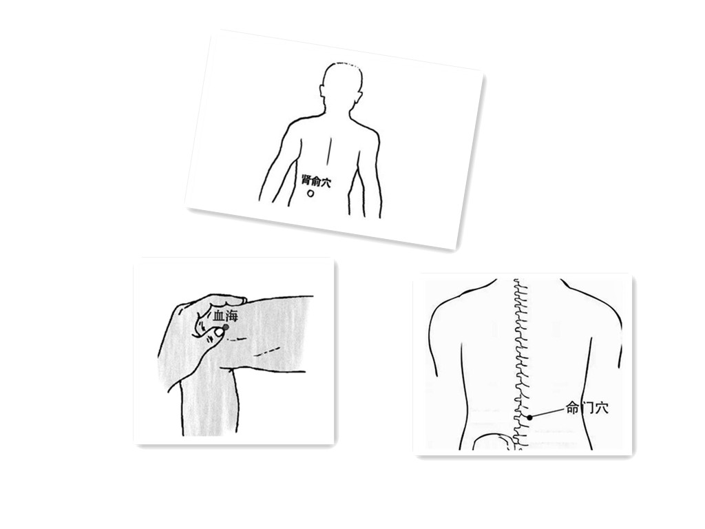 心律失常中医针灸能调好吗,针灸可以治疗心律失常吗