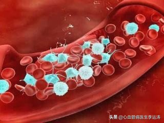 病人血小板低该吃什么药防治心梗,预防心梗复发阿司匹林用量