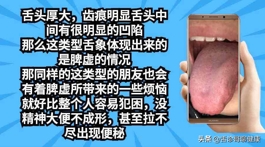 抖音舌诊哥,舌诊歌舌象分析和感悟