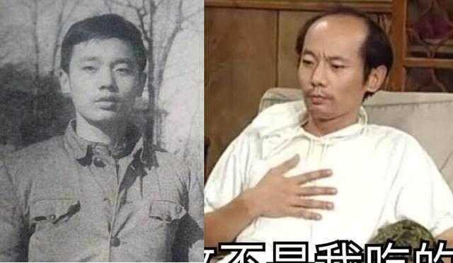 陈奕迅秃顶头发稀疏,陈奕迅同款发际线怎么补救