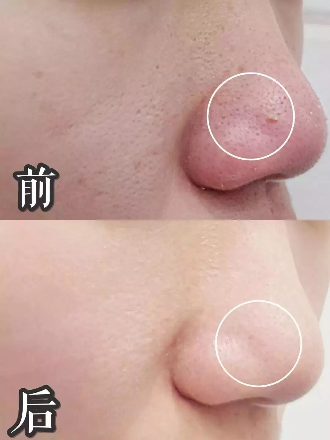 网红氨基酸洁面乳测评,平价氨基酸洁面产品测评