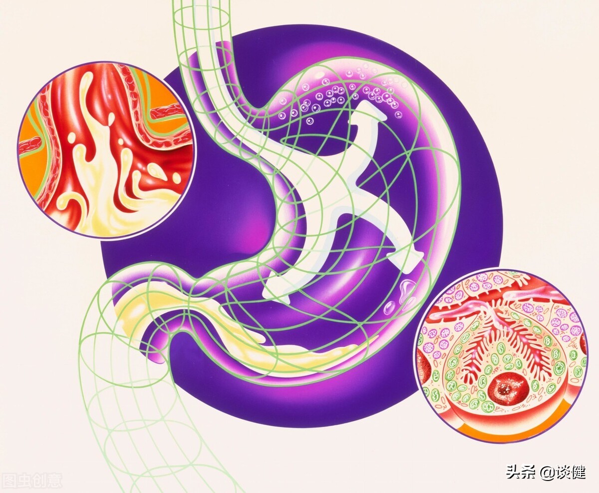 胃酸过多胃胀用哪种胃药最有效,胃酸吃什么胃药最快