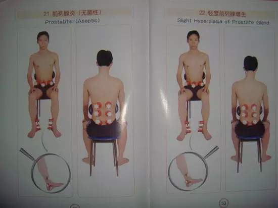 拔罐有哪些穴位图解,最全拔罐穴位疗法图解