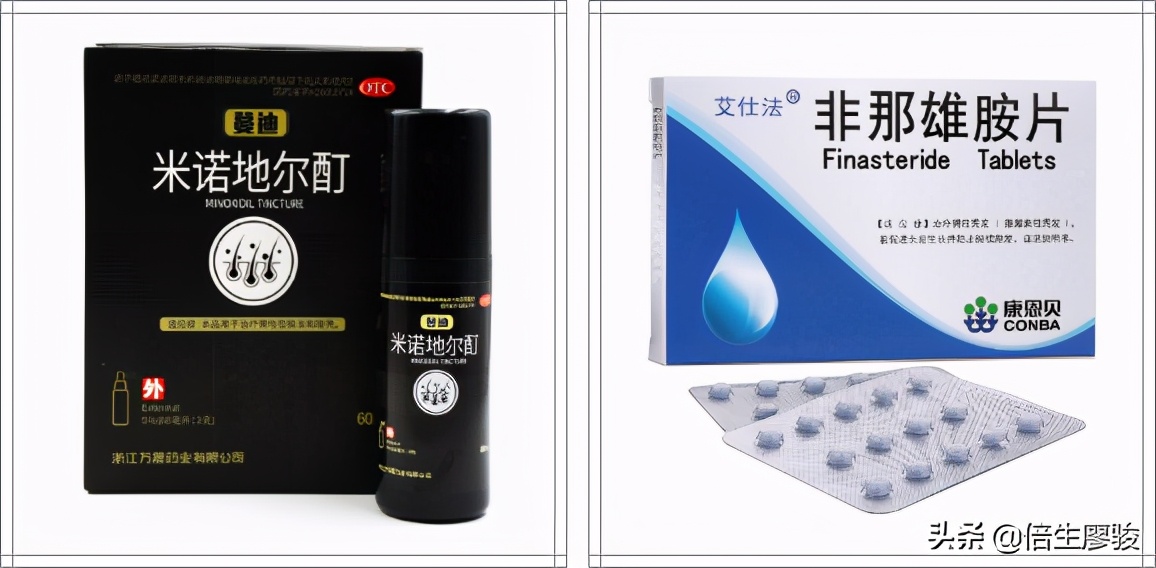 女性脱发严重10个原因,脱发严重怎么解决