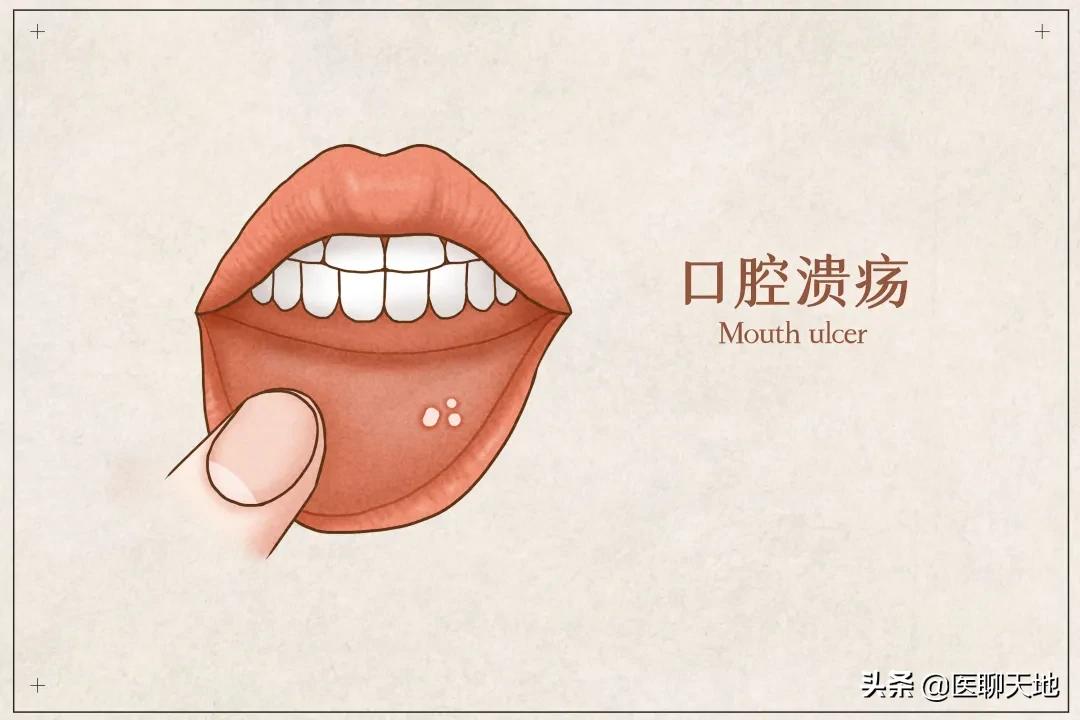 嘴巴撕死皮疼怎么办,嘴巴内壁红肿痛怎么办