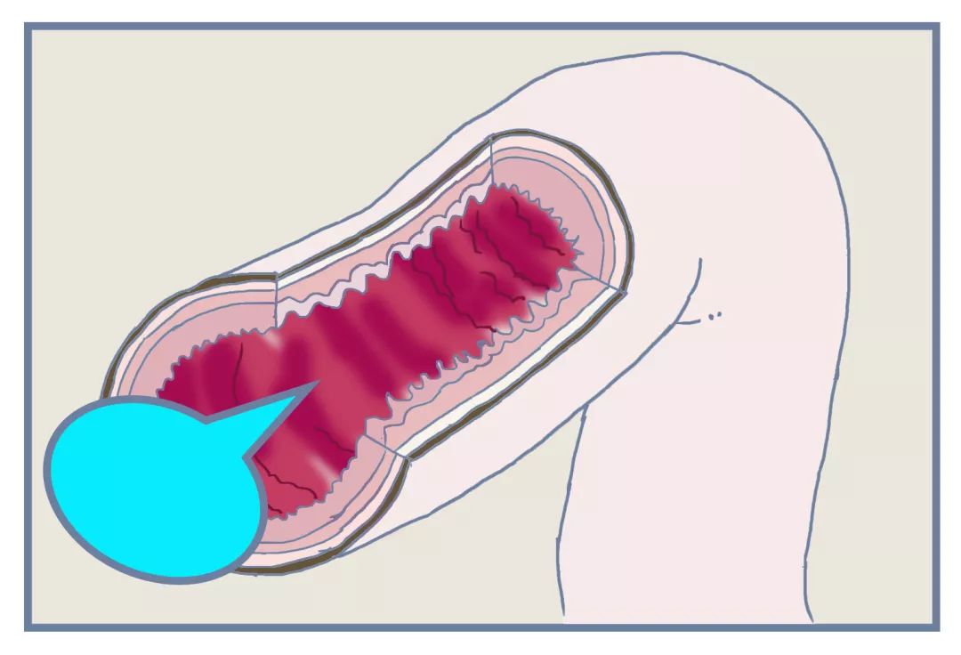 便秘在药店推荐的药品,大家都在用什么药治疗便秘