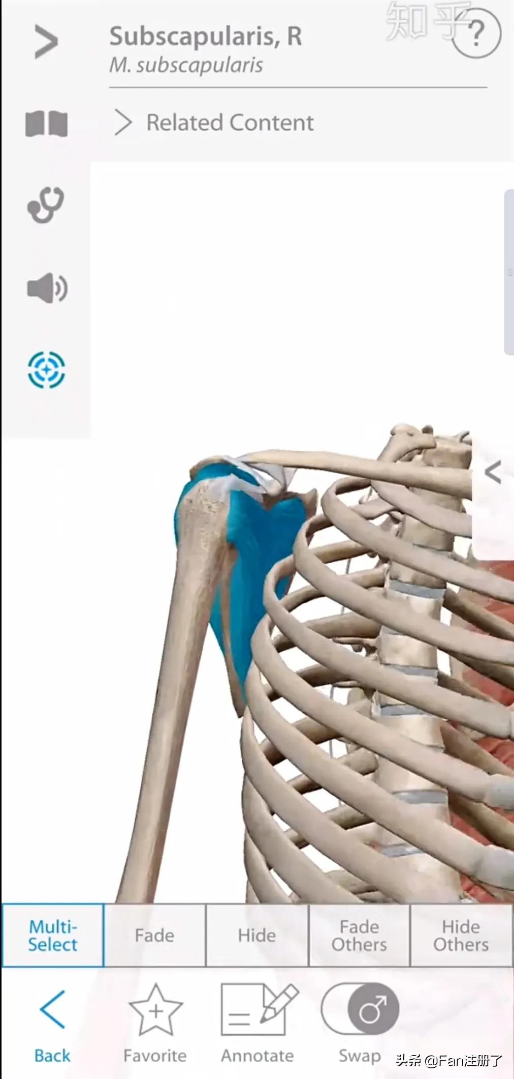 肩痛肩袖损伤针刀治疗,肩痛肩关节活动受限用什么药