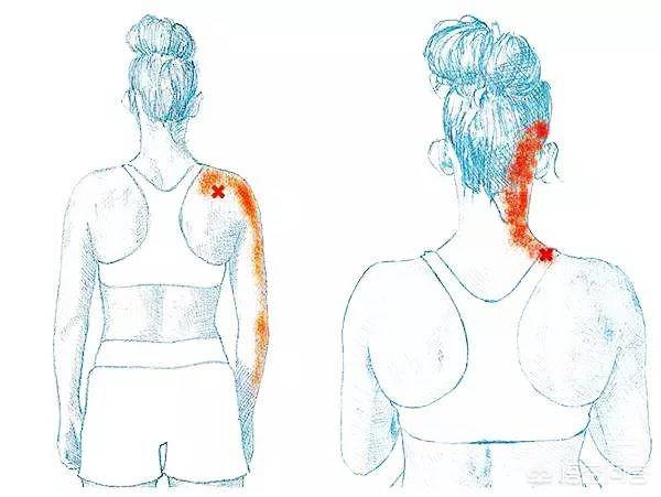 颈椎病患者如何选用枕头,神经型颈椎病枕高枕头还是低枕头