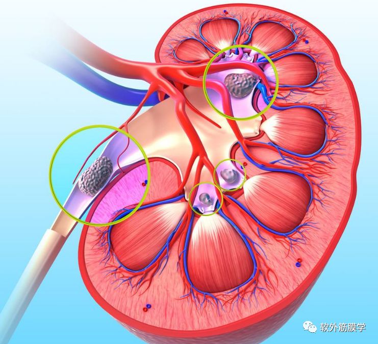 针刺运动疗法和针灸区别,针刺法与灸法的关系