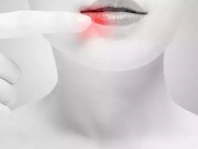 经常上火是什么原因导致的,上嘴唇上火是什么原因